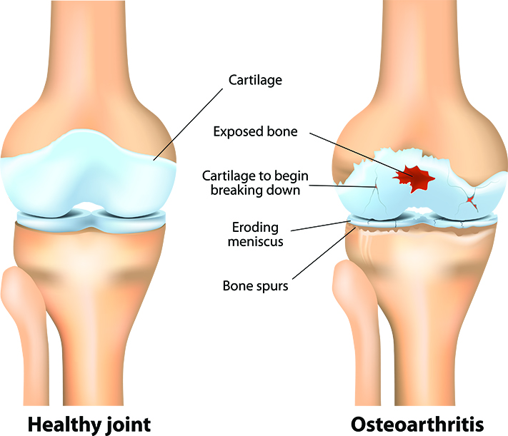 Knee joint