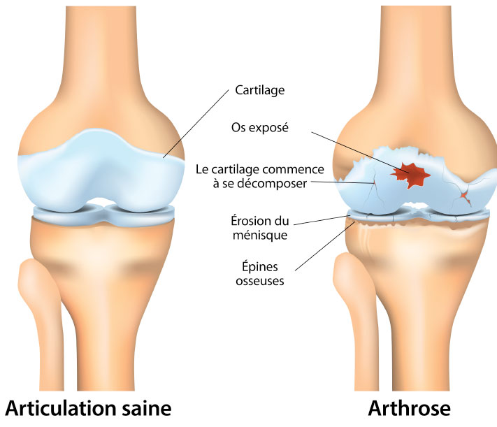 Knee joint