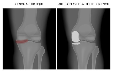 knee xray