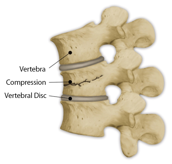 Close up of a spine