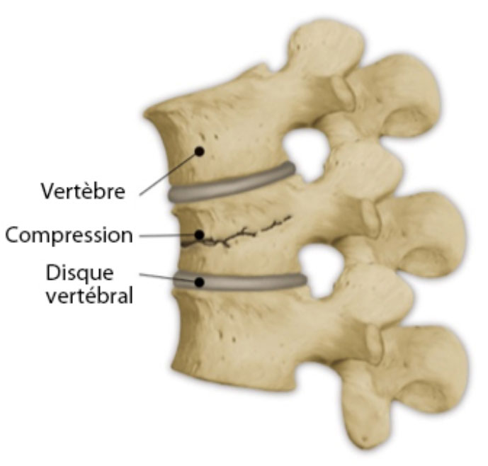 Close up of a spine