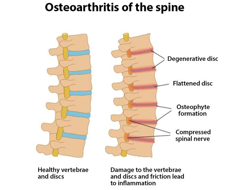 spine